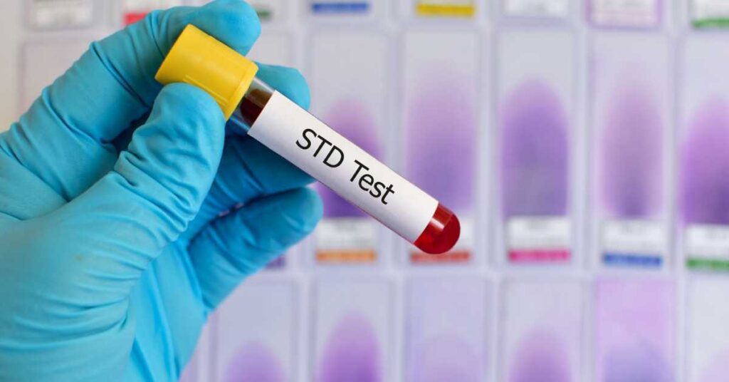 STD Test